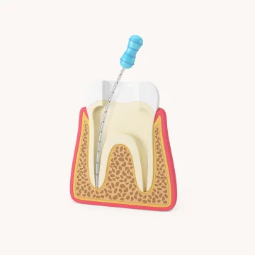 서울디테일치과 진단 및 계획
