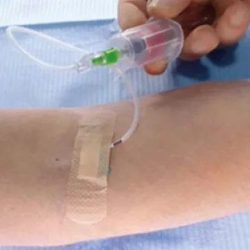 서울디테일치과 3D 정밀 검사 후 PRF 식립 계획 수립