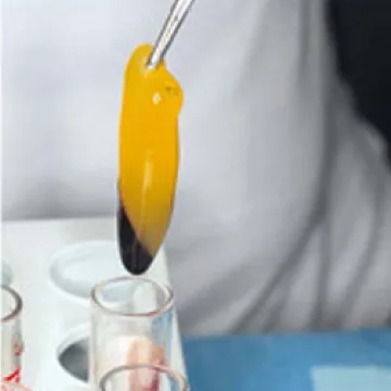 서울디테일치과 원심 분리하여 고농축 PRF 추출